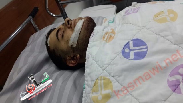 عاجل : اصابة حرجة لشاب قسماوي بعد تعرضة لاعتداء من قبل متطرفين يهود 
